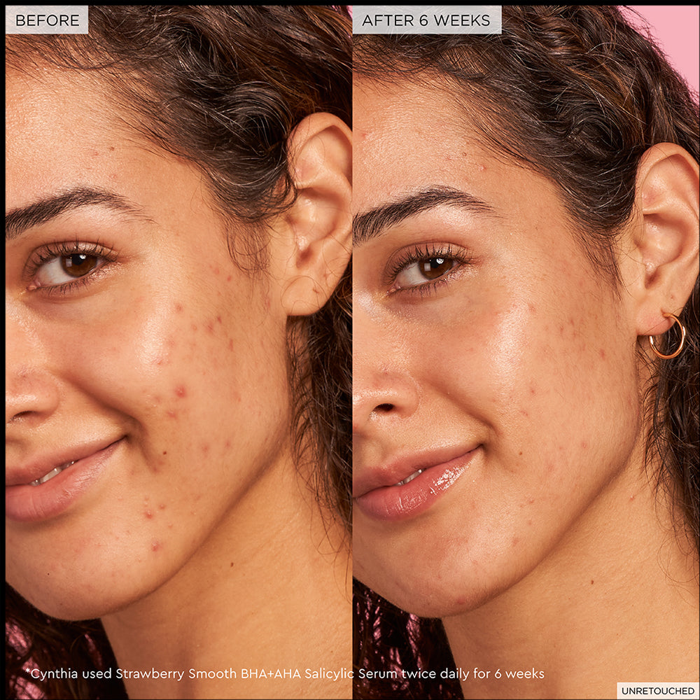 Glow Recipe Strawberry Smooth BHA + AHA Salicylic Acid Serum